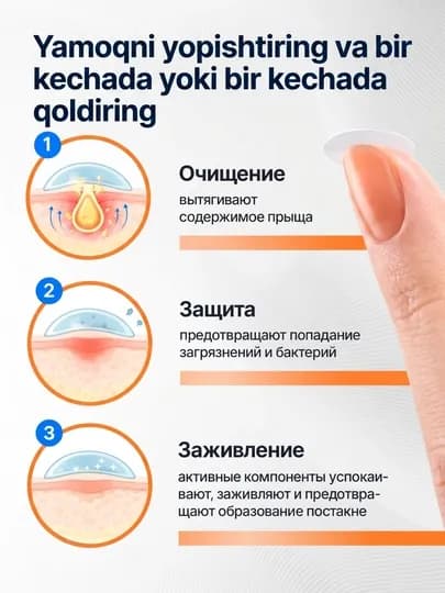 Патчи точечные против акне и прыщей ZODIAC, пластыри для проблемной кожи лица, 72 шт — ZODIAC-Z41
